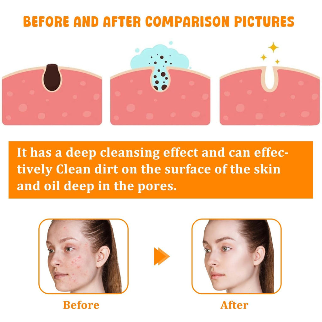 Revitalize Your Skin with Our Nourishing Turmeric Facial Cleanser - Gentle Foaming Wash for All Skin Types